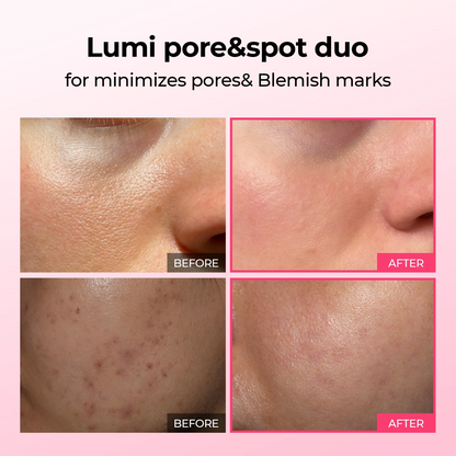 Lumi firm & lift Duo